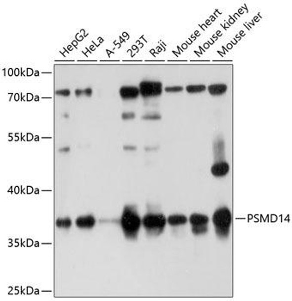 Epigenetics and Nuclear Signaling Antibodies 1 Anti-PSMD14 Antibody CAB10782