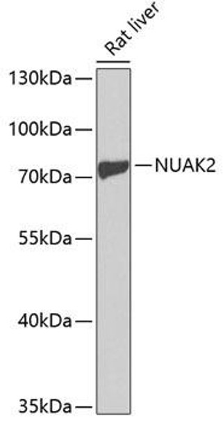 Cell Death Antibodies 1 Anti-NUAK2 Antibody CAB1079