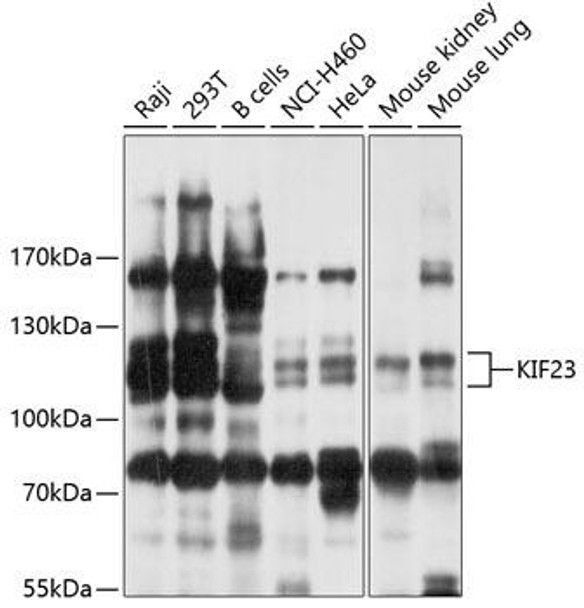 Cell Cycle Antibodies 1 Anti-KIF23 Antibody CAB10800