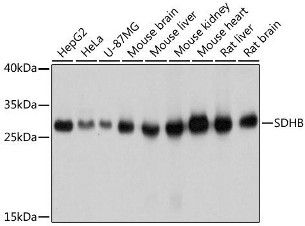 Cell Biology Antibodies 2 Anti-SDHB Antibody CAB10821