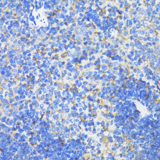 Cell Biology Antibodies 2 Anti-SDHB Antibody CAB10821