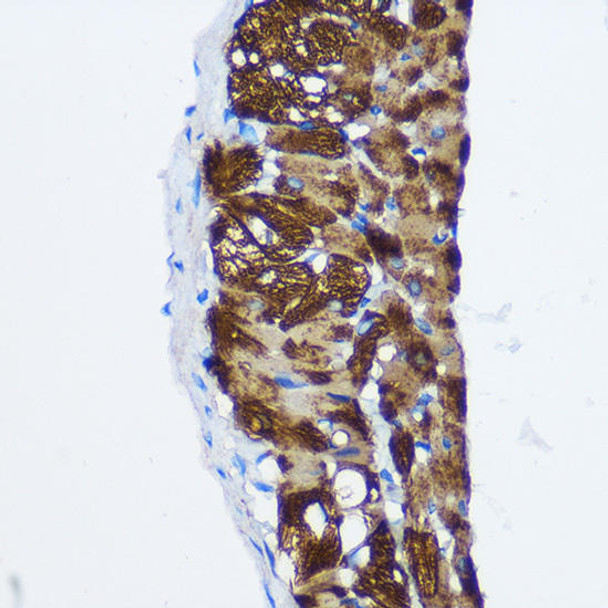 Cell Biology Antibodies 2 Anti-PPP1CB Antibody CAB1088