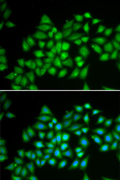 Cell Biology Antibodies 2 Anti-ATP2A2 / SERCA2 Antibody CAB1097