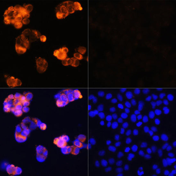 Cell Biology Antibodies 2 Anti-AFP Antibody CAB11013