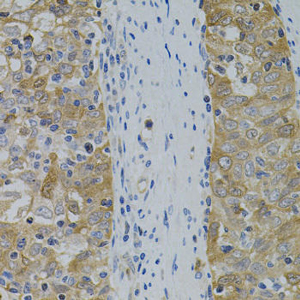 Cell Death Antibodies 1 Anti-APP Antibody CAB11019