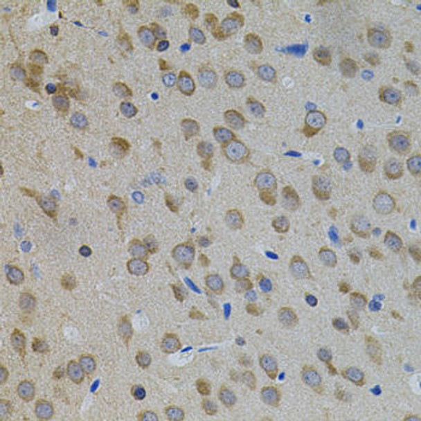 Cell Death Antibodies 1 Anti-APP Antibody CAB11019