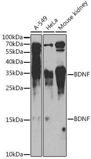 Cell Biology Antibodies 2 Anti-BDNF Antibody CAB11028