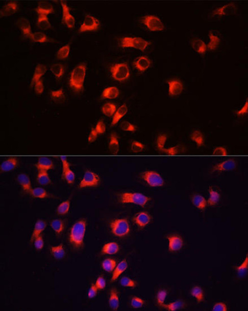 Cell Biology Antibodies 2 Anti-Tau Antibody CAB1103