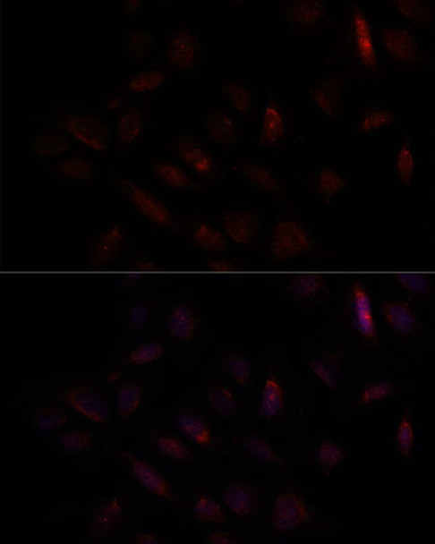 Cell Cycle Antibodies 1 Anti-BRCA1 Antibody CAB11034