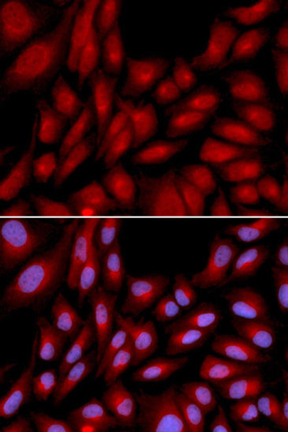 Cell Death Antibodies 1 Anti-BAG1 Antibody CAB1104