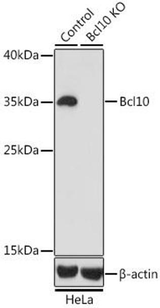 KO Validated Antibodies 1 Anti-Bcl10 Antibody CAB1106KO Validated