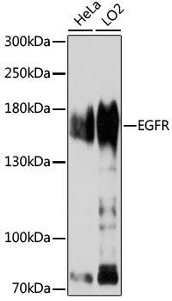 Immunology Antibodies 1 Anti-EGFR Antibody CAB11082