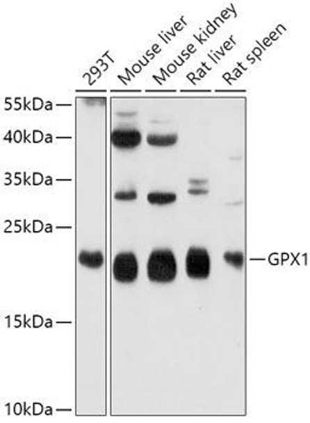 Cell Biology Antibodies 2 Anti-GPX1 Antibody CAB1110