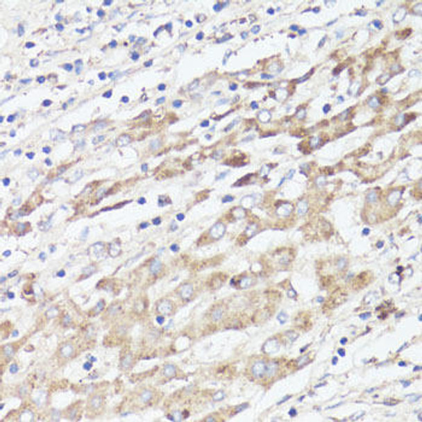 Cell Biology Antibodies 2 Anti-IGFBP1 Antibody CAB11109