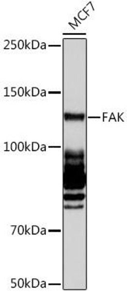 Cardiovascular Antibodies Anti-FAK Antibody CAB11131