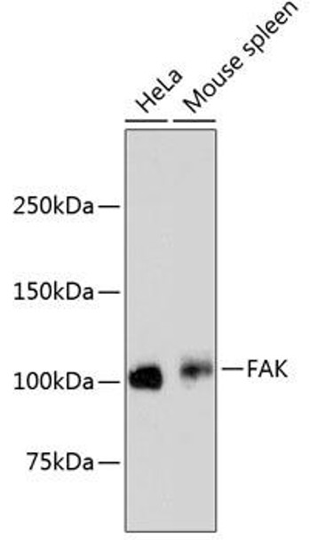 Cardiovascular Antibodies Anti-FAK Antibody CAB11131