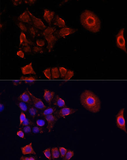 Developmental Biology Anti-DAZL Antibody CAB1114