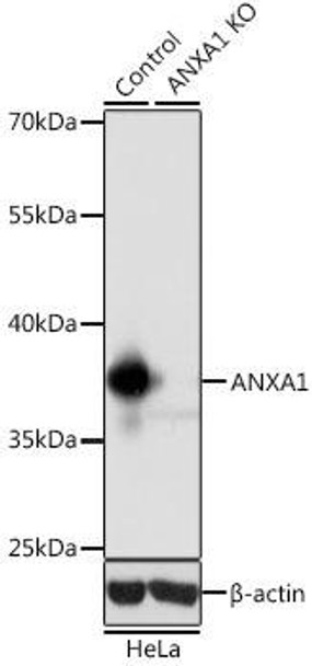 KO Validated Antibodies 1 Anti-ANXA1 Antibody CAB1118KO Validated