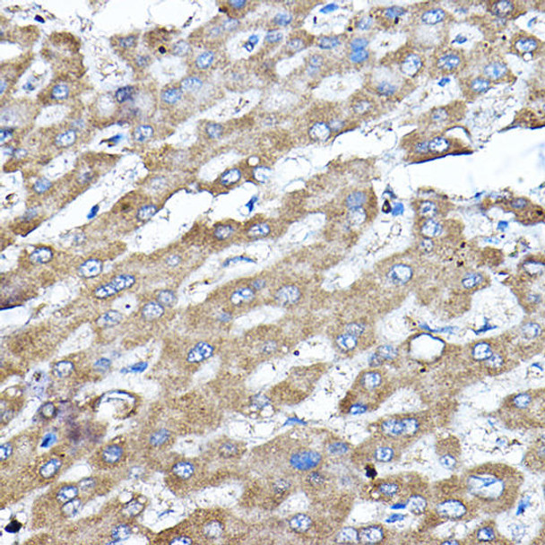 KO Validated Antibodies 1 Anti-ERK2 Antibody CAB11186KO Validated