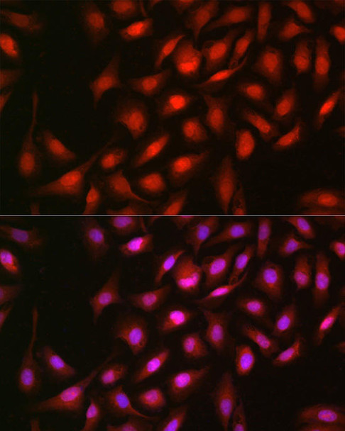 KO Validated Antibodies 1 Anti-ERK2 Antibody CAB11186KO Validated