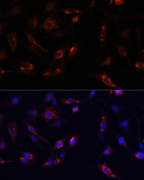 Cardiovascular Antibodies Anti-FAK Antibody CAB11195