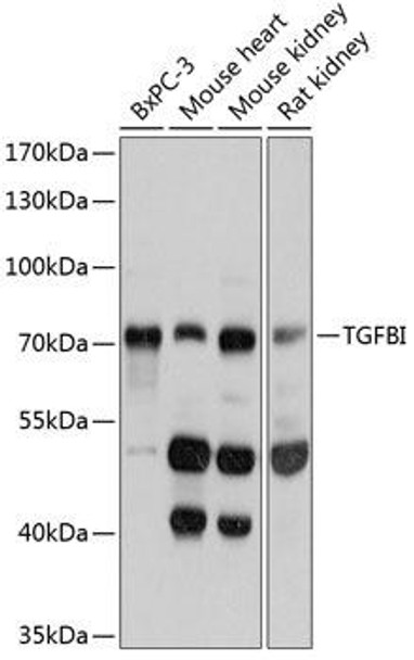 Cell Biology Antibodies 2 Anti-TGFBI Antibody CAB11222