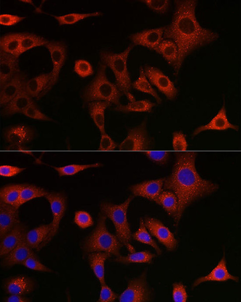 Cell Death Antibodies 1 Anti-SQSTM1 / p62 Antibody CAB11247