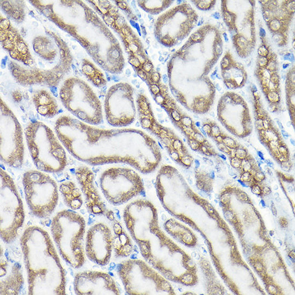 Cell Death Antibodies 1 Anti-SQSTM1 / p62 Antibody CAB11247