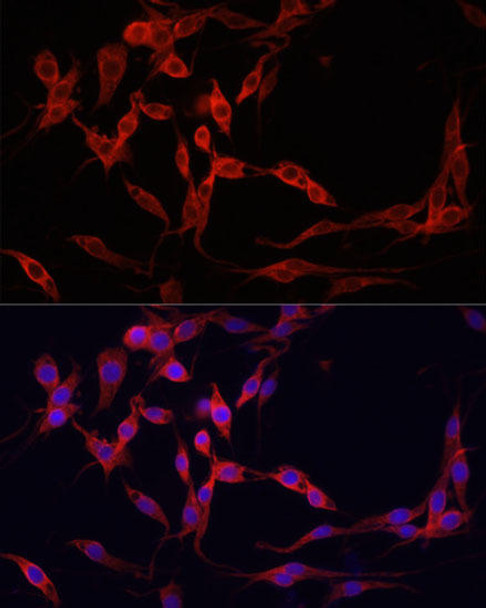 KO Validated Antibodies 1 Anti-YAP1 Antibody CAB11264KO Validated