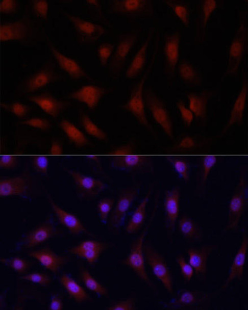 Epigenetics and Nuclear Signaling Antibodies 1 Anti-YAP1 Antibody CAB11265