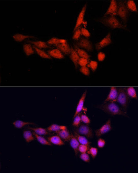 KO Validated Antibodies 1 Anti-SIRT1 Antibody CAB11267KO Validated