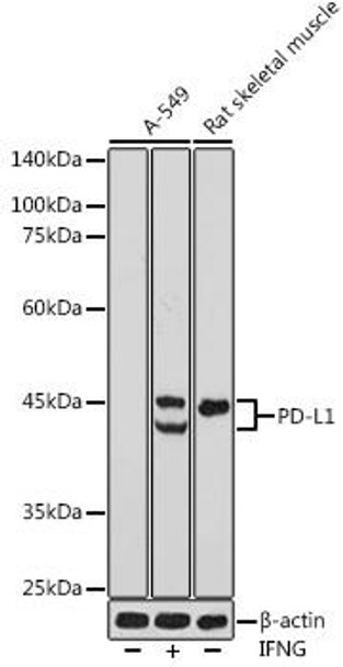 Immunology Antibodies 1 Anti-PD-L1 Antibody CAB11273