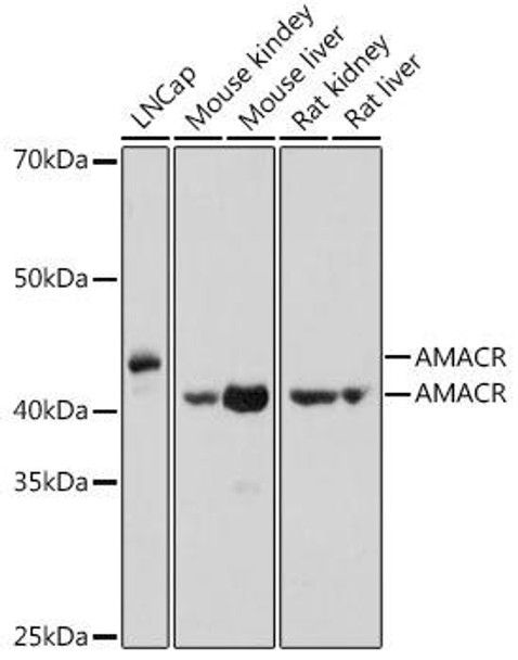 Cell Biology Antibodies 2 Anti-AMACR Antibody CAB1130
