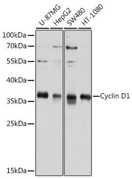 Cell Cycle Antibodies 1 Anti-Cyclin D1 Antibody CAB11310