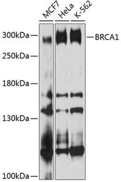 Cell Cycle Antibodies 1 Anti-BRCA1 Antibody CAB11318