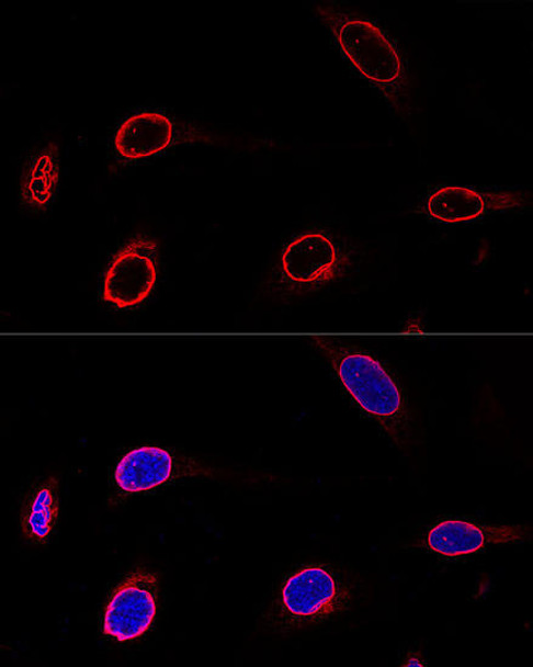 Cell Biology Antibodies 2 Anti-EMD Antibody CAB1132