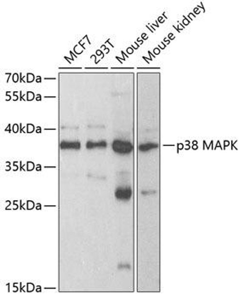 Cell Death Antibodies 1 Anti-p38 MAPK Antibody CAB11340