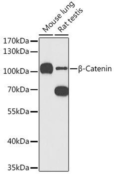 KO Validated Antibodies 1 Anti-Beta-Catenin Antibody CAB11343KO Validated