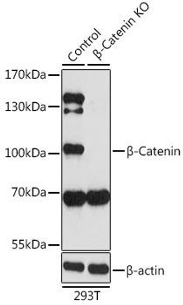 KO Validated Antibodies 1 Anti-Beta-Catenin Antibody CAB11343KO Validated