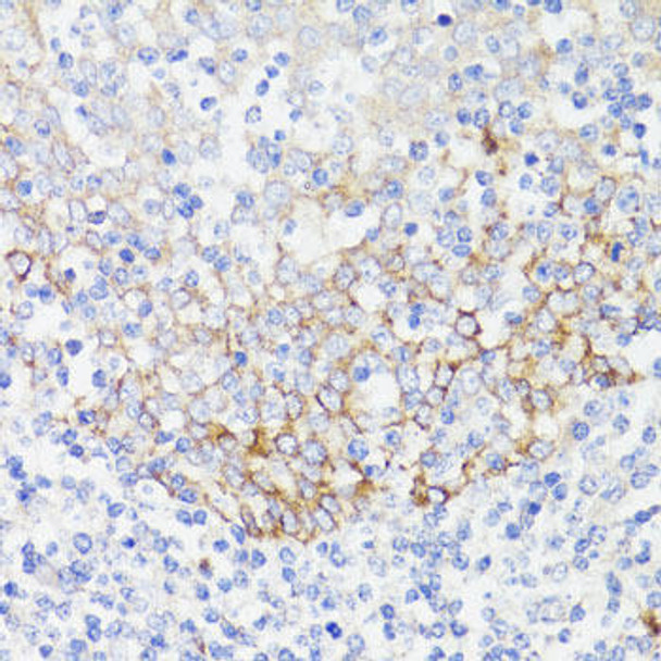 Immunology Antibodies 1 Anti-EGFR Antibody CAB11352