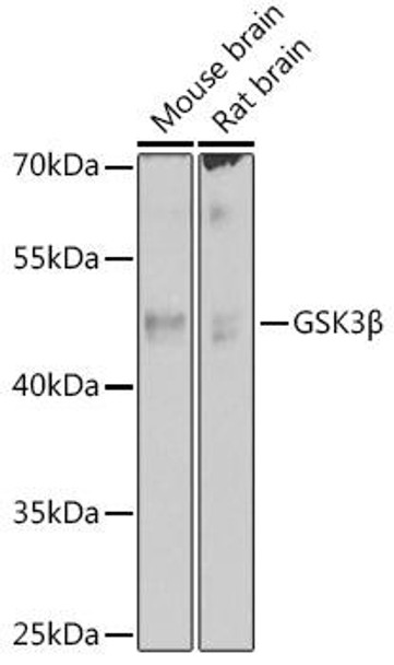 Cell Biology Antibodies 2 Anti-GSK3Beta Antibody CAB11360