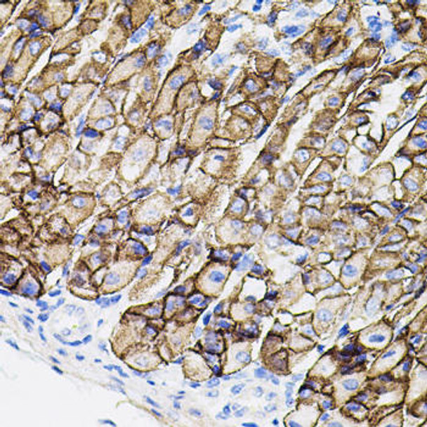 Cell Biology Antibodies 2 Anti-MMP9 Antibody CAB11391