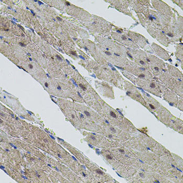 Epigenetics and Nuclear Signaling Antibodies 1 Anti-MYC Antibody CAB11394