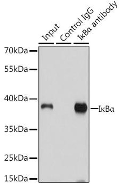 KO Validated Antibodies 1 Anti-IkBAlpha Antibody CAB11397KO Validated