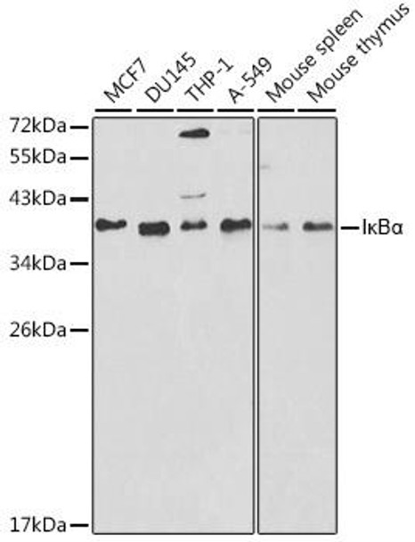 KO Validated Antibodies 1 Anti-IkBAlpha Antibody CAB11397KO Validated