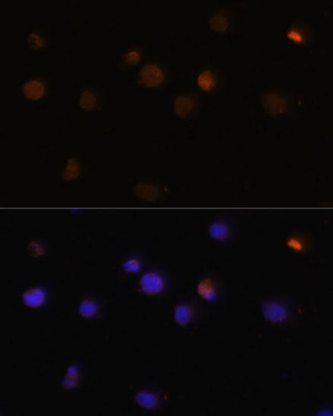 Cell Cycle Antibodies 1 Anti-RB Antibody CAB11409