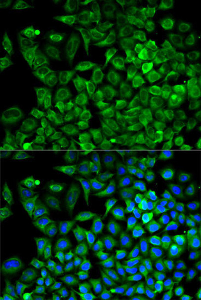 Metabolism Antibodies 1 Anti-ALDOA Antibody CAB1142