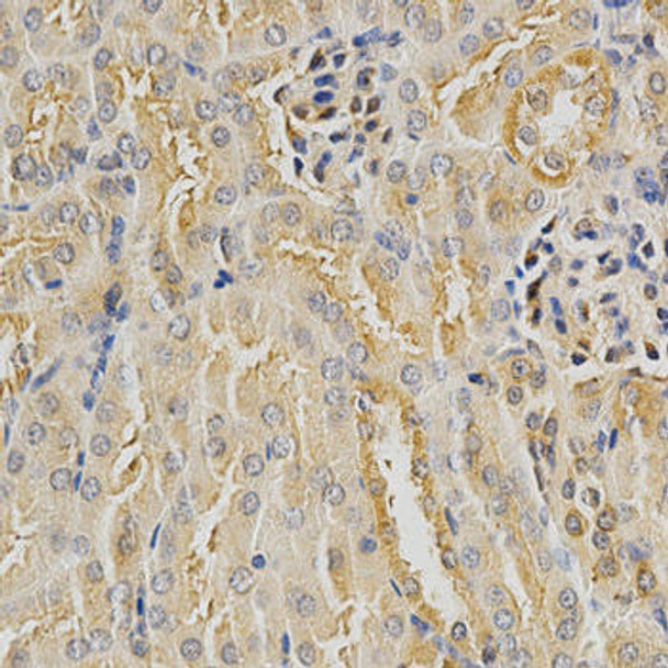 Autophagy Antibodies Anti-HDAC6 Antibody CAB11429