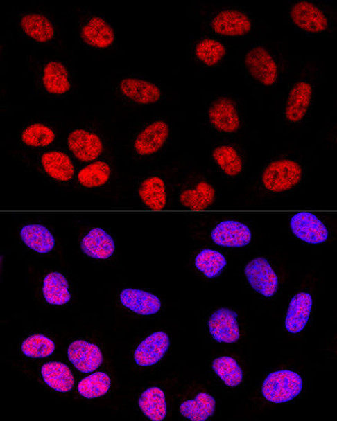 Epigenetics and Nuclear Signaling Antibodies 1 Anti-SOX2 Antibody CAB11501