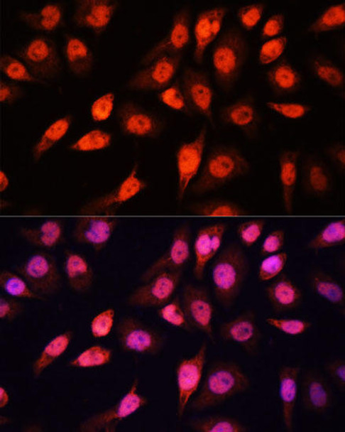 Epigenetics and Nuclear Signaling Antibodies 1 Anti-SOX2 Antibody CAB11501